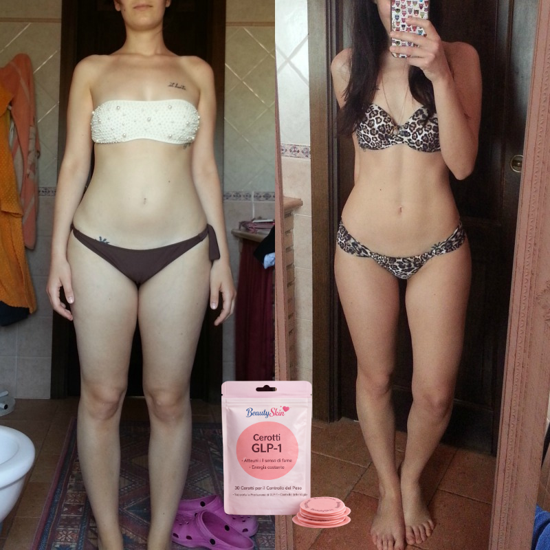 Cerotti Dimagrenti BeautySkin