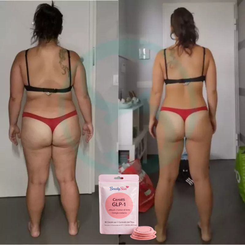 Cerotti Dimagrenti BeautySkin